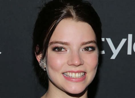 anya taylor-joy teeth|Anya Taylor